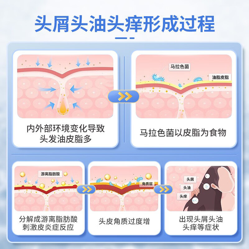 为何头皮屑总爱“找茬”，选对洗发水是关键