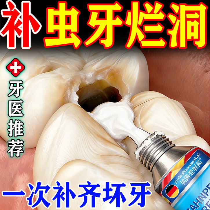 Tooth Filling Kit for Self-Filling at Home, Tooth Decay Repair and Cleaning, Permanent Medical Tooth Cavity Filling Paste