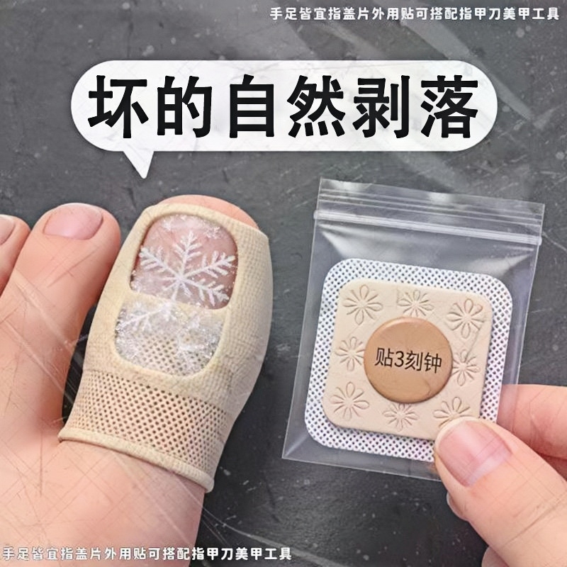 [German Specialization] Specialized Nail Removal Patch for Fungal Infections [Bacteria] with Plant Extracts, Genuine Product for Toenails and Fingernails, Universal Use