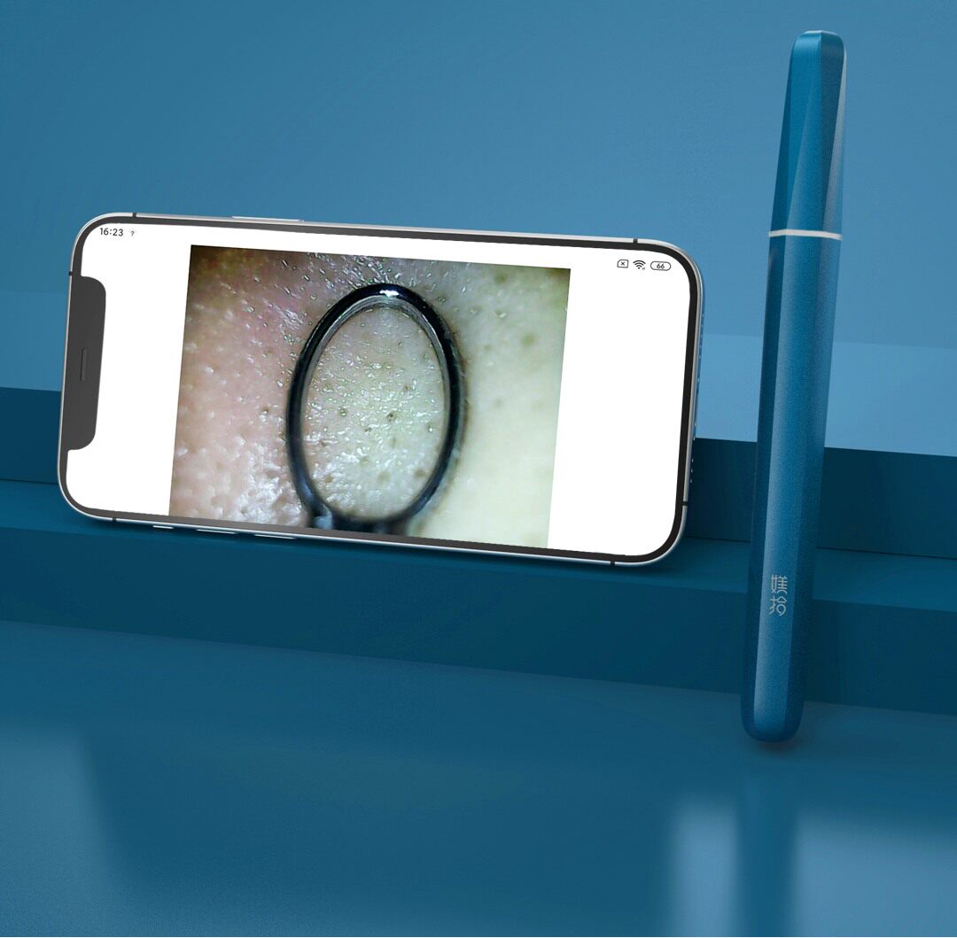 吸黑头祛痘神器 小米有品 媄拾 智能可视毛孔清洁仪 双重优惠折后￥99包邮 2色可选 京东￥159