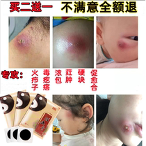 Fire boils to pull out poison and pus ointment to pull out pus stickers to suck pus head swollen hard lump thick pimple pustule sit board sore fire boil artifact