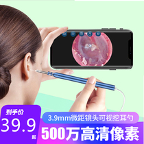 Ear artifact high-definition visual ear scoop tool set endoscopic otoscope ear mirror buckle earwax