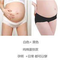 Кружевый край черный + кружевный край белый (чистый хлопок)