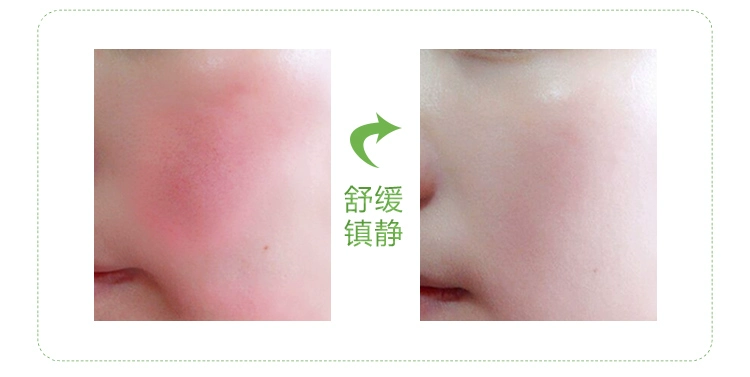 Extra Philippine Mint Face Facial Cream Cream Cleansing Cream Anti-Acne Deep Cleansing Skin làm giảm lỗ chân lông - Kem massage mặt