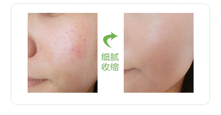Bạc hà mặt massage mặt kem làm sạch kem trị mụn sâu làm sạch và làm sạch lỗ chân lông thẩm mỹ viện đặc biệt thương hiệu kem matxa mặt
