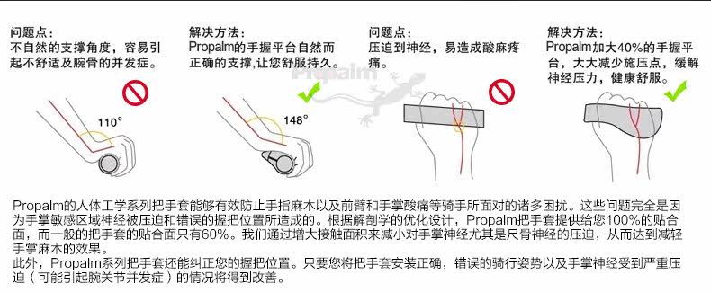 Poignées de vélo PROPALM - Ref 2340788 Image 9