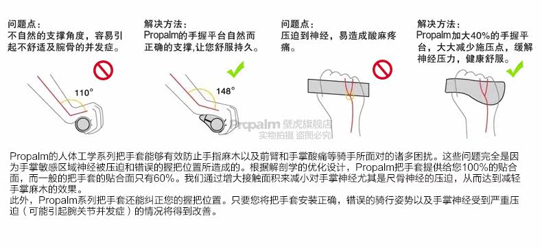 Poignées de vélo PROPALM - Ref 2354038 Image 8