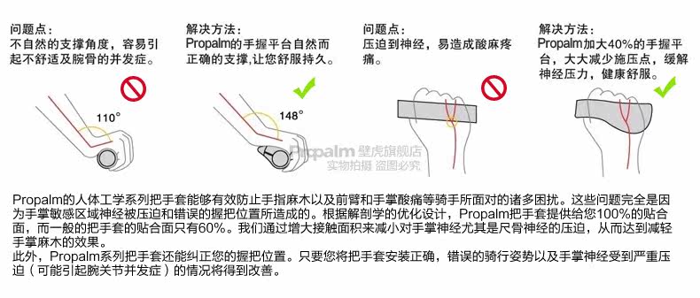 Poignées de vélo PROPALM - Ref 2354044 Image 7