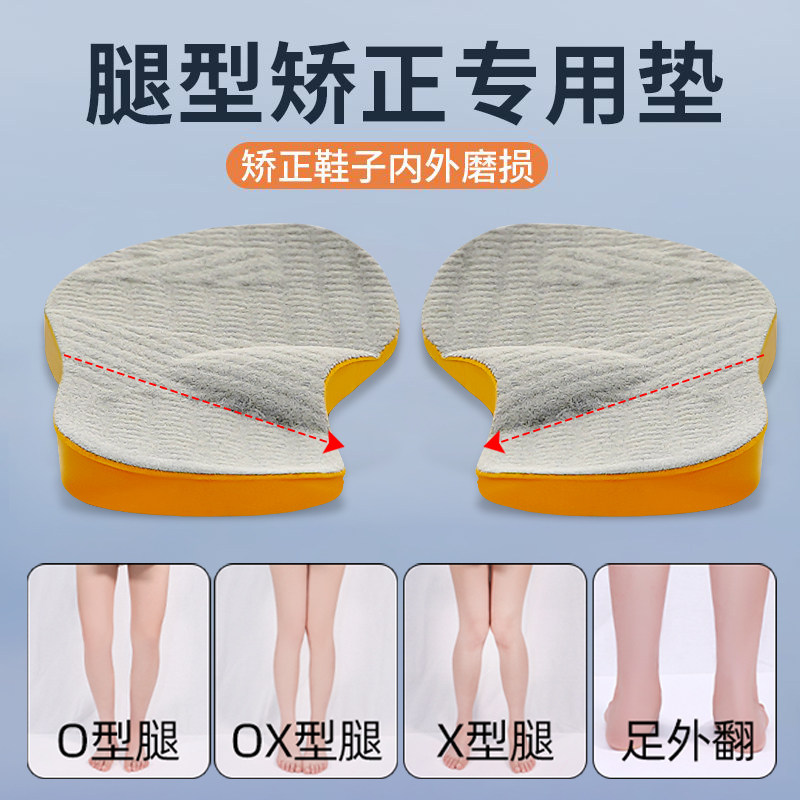 小腿外翻膝盖内翻内扣内旋矫正器腿形内八外八字鞋垫腿型直腿神器