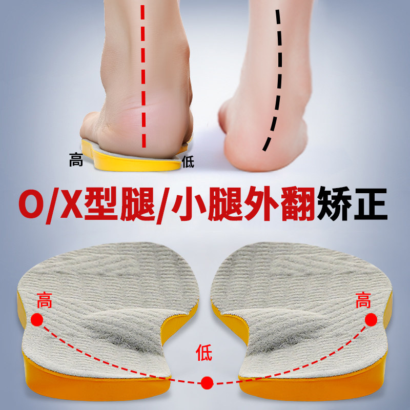矫正鞋垫外八字小腿足内翻罗圈腿腿型直腿矫正器纠正鞋底外侧磨损