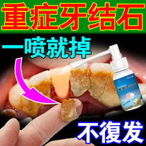 Dental calculus dissolving calculus quick-acting remover mouthwash sterilization bad breath yellow washing white smoke stains black dirt artifact