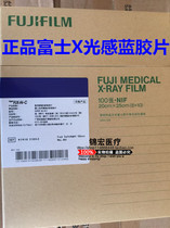 Fujifilm medical X-ray film sensing blue X-Ray Film 8*10X12X15 medical cassette intensifying screen