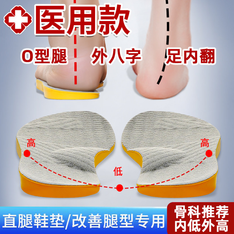 腿型矫正器XO型腿小腿外翻膝盖内旋直腿神器鞋垫内八外八字脚纠正