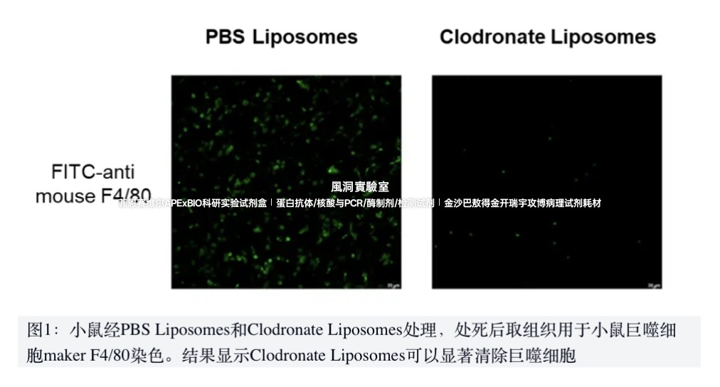 APExBIO巨噬细胞清除试剂盒Macrophage Depletion Kit高清除效率