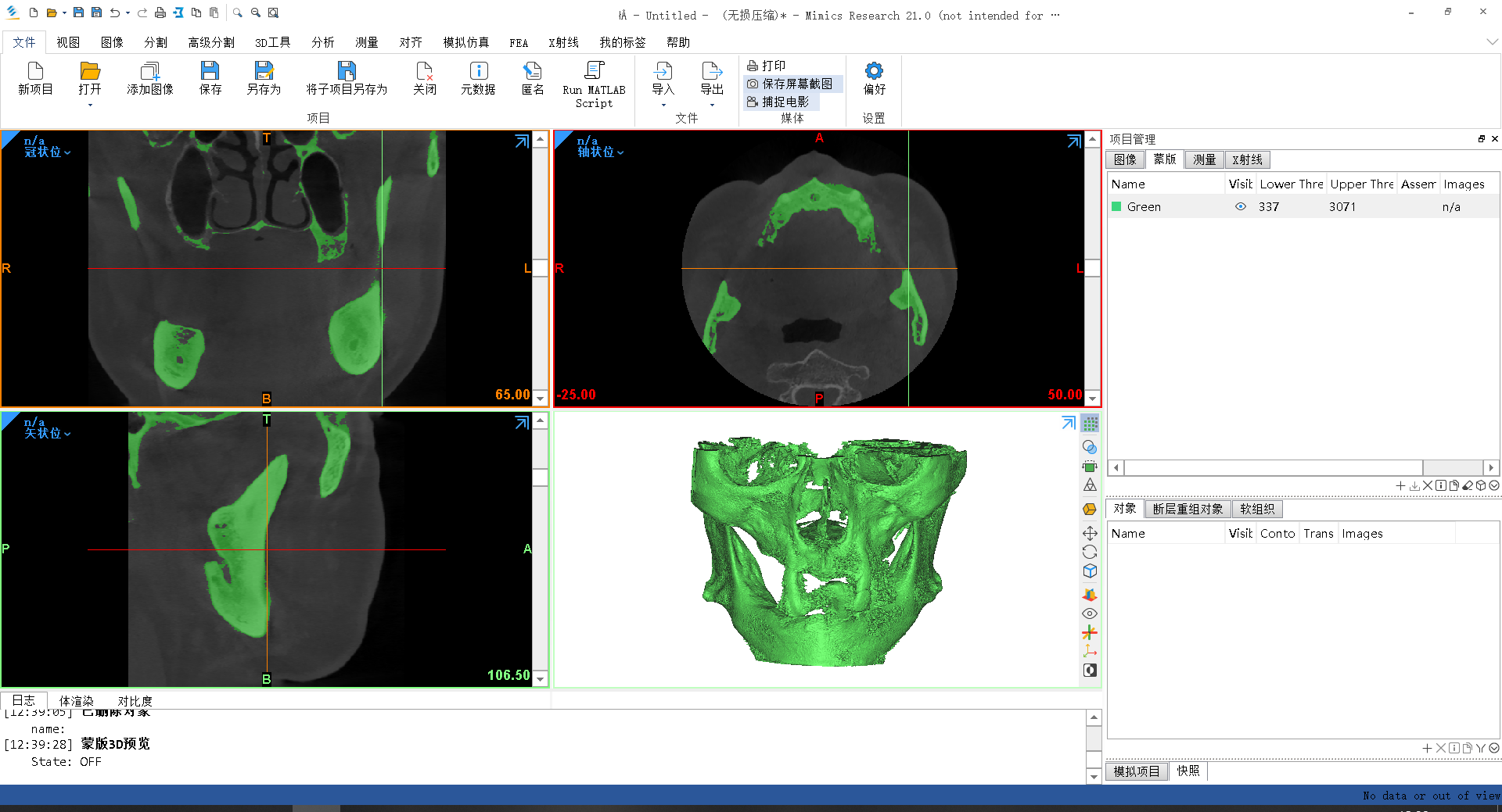 MIMICS 21版漢化 醫學有限元Mimics2021穩定中文版 CT建模三維重-Taobao