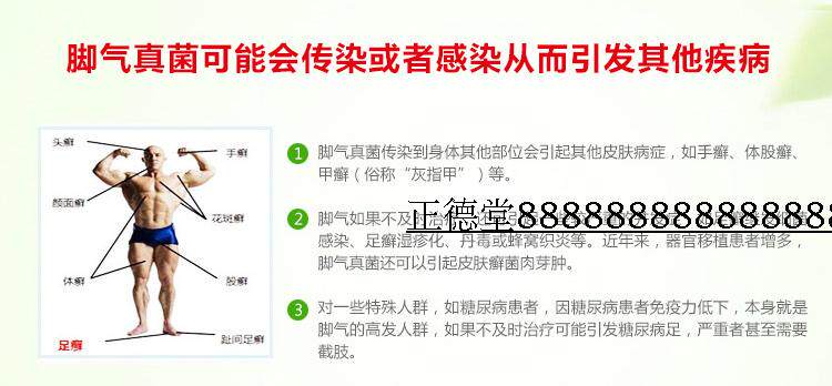 治脚气止痒脚臭去脚气水泡脱皮脚痒糜烂脚丫型香港脚汗喷剂药膏王] _ 