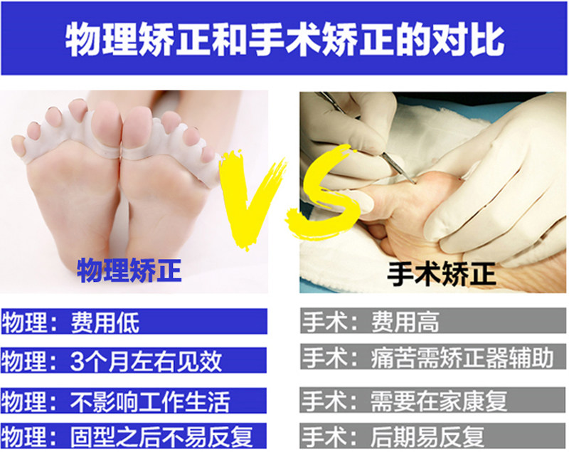 分趾器大腳骨拇外翻器小拇指外翻分趾器小腳趾頭硅膠分離器日本設計 一級棒 露天拍賣