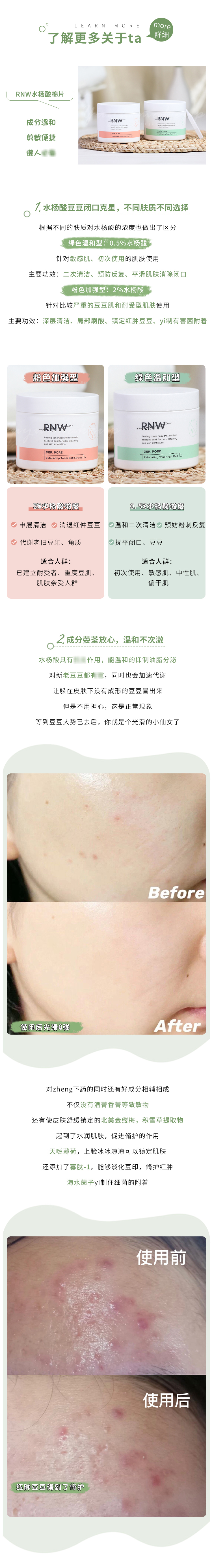 Meng Dayu RNW Salicylic Acid Cotton Sheet Chải nhẹ nhàng để loại bỏ các vết mụn ở miệng, mụn đầu đen, mụn trứng cá và thu nhỏ lỗ chân lông mặt nạ innisfree đất sét