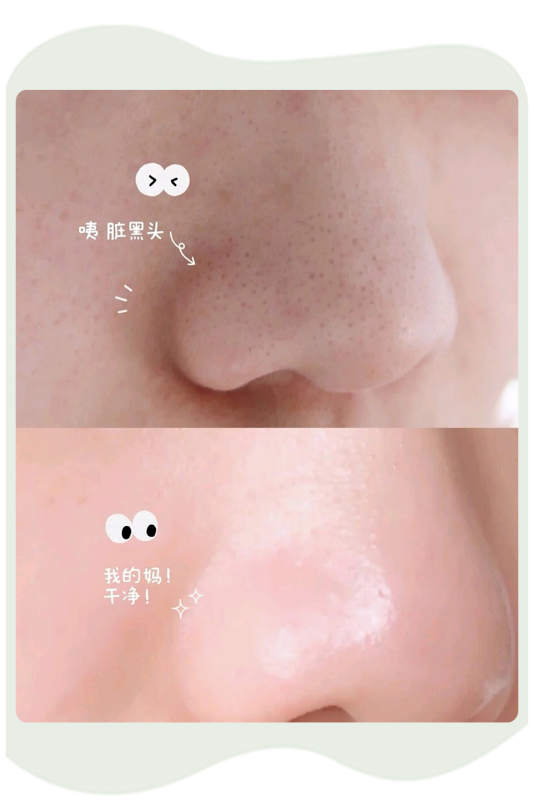 Miếng dán mũi Moe Dayu eiio làm sạch sâu loại bỏ mụn đầu đen và trắng thu nhỏ lỗ chân lông làm mới kiểm soát dầu vùng kín nạ innisfree