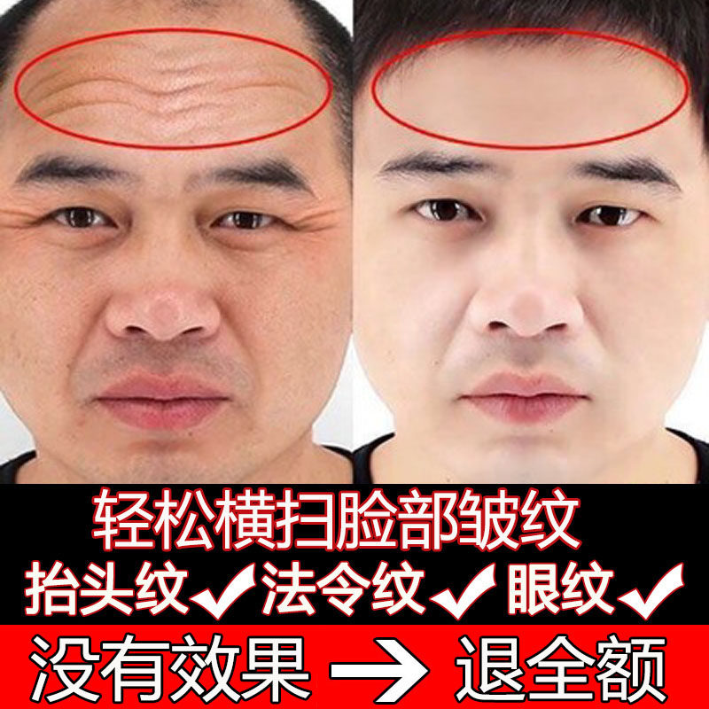Removal of wrinkles artifact lifting head lines to remove men's pulling and firming hexapeptide anti-wrinkle cream anti-aging skin care products