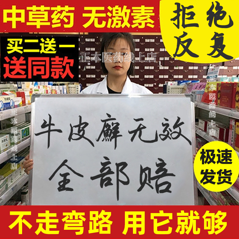 External skin with psoriasis scalp moss psoriasis, itching and itching eczema dehydration of moss