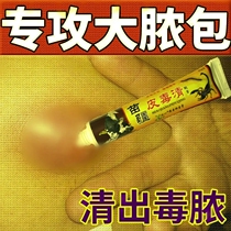 Miaofang fire boils pulls poison and pulls pus cream red swollen pus hard block sitting sore buttocks boils acne pus sucking artifact