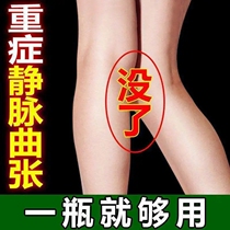 Varicocele special ointment leg blood vessel swelling earthworm blue tendon bulge external pain cold compress gel