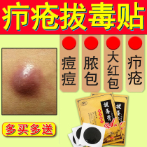 (Fire boils stick to remove the poison and remove the pus) the fungal infection of the buttocks the thick bag the sore the swell and the pus-absorbing sticker