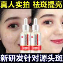 Age spots strong removal whitening and freckle serum anti-wrinkle melanin remove hand and face melasma cream