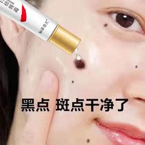 The ointment to remove age spots strongly removes the old mans back freckle cream whitening and lightening stains essence official