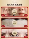 [Xiaohongshu рекомендует анти -wrinkle uer ~] не позволяйте указу разоблачить ваш возраст, чтобы разбавить схему указа ~