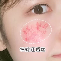[Xiaohongshu рекомендует купить 2 Get 1 Get 1] Fack Red Dots на лице Red Dots ~ Не красное лицо ~ Держитесь подальше от плато красным