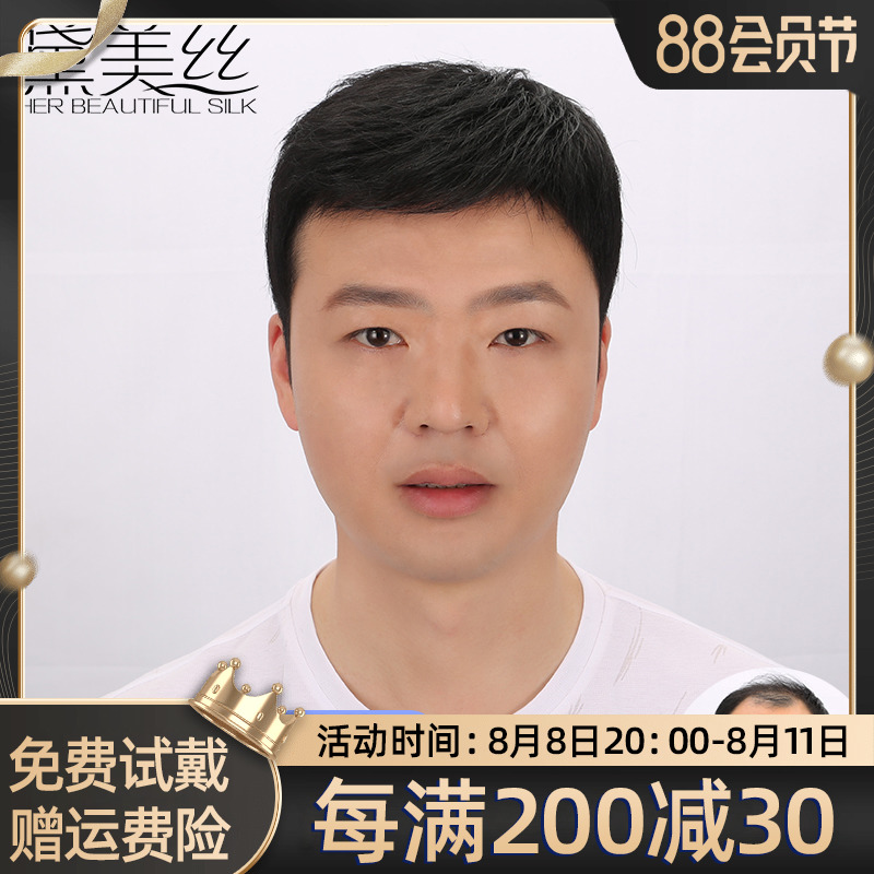 Men's wire hair hair hair hair hair hair hair hair hair hair hair hair hair hair top bald hair replenishment block