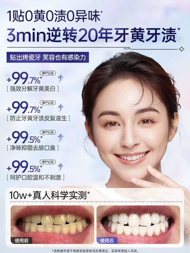 Отбеливающие зубные наклейки на зубы, чтобы удалить желтый, белый, белый, белый артефакт, патч скорость ярко -белый флагов