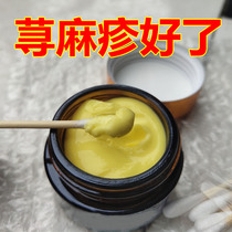 Lis Baicao is eager to find urticaria allergic and anti-itching root special drug rage scratch Japanese spray