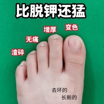 ⭐Oriental Selection⭐The effect is so good. One drop will turn bad nails into good nails. Buy 2 and get 1 free. Buy 3 and get 2 free.