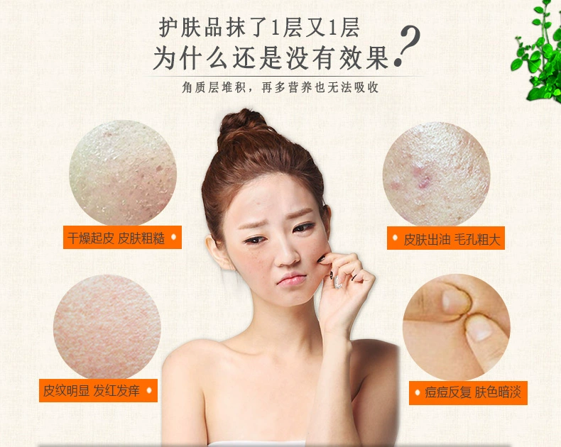 Western Platinum Exfoliating Facial Gentle Exfoliating Gel Scrub Body Deep Cleansing Chicken Skin Chính hãng dành cho nam và nữ kem tẩy da chết body