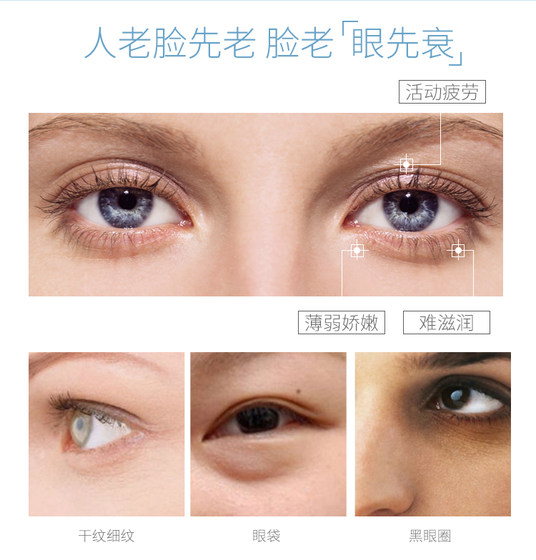 Beijing 301 Hospital Jingwei herbal propolis nourishing and firming eye cream anti-wrinkle dilutes fine lines eye bags dark circles