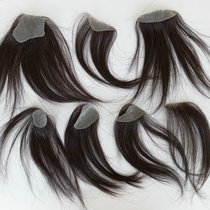 Head scars scars replacement pieces small areas sticky hair pieces mens burns scalds sticky scalp wigs