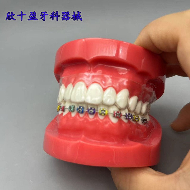 口腔门诊医患沟通讲解练习用正畸模型 金属陶瓷自锁托槽对比模型