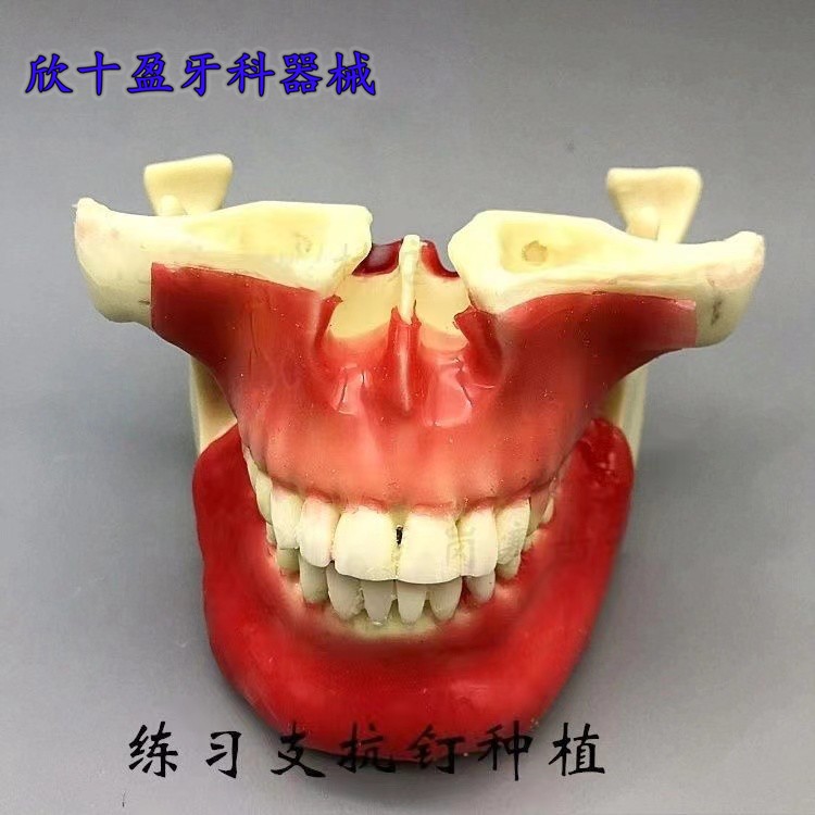 牙科口腔模型 支抗钉练习种植模型 学生练习模型仿真骨模型 m2031