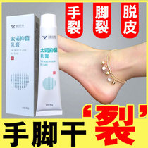 (Buy 5 and get 1 free)Tano antibacterial cream Zheng Yuanyuan peeling and cracking gray toenail antibacterial