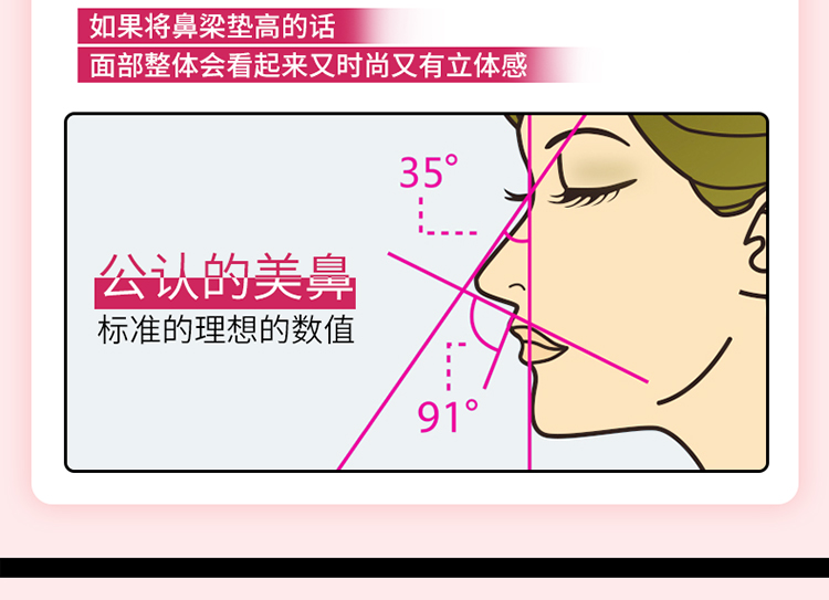 日本卡通鼻夾塑形矯正鼻樑器美鼻神器縮小鼻翼鼻子變挺鼻樑夾