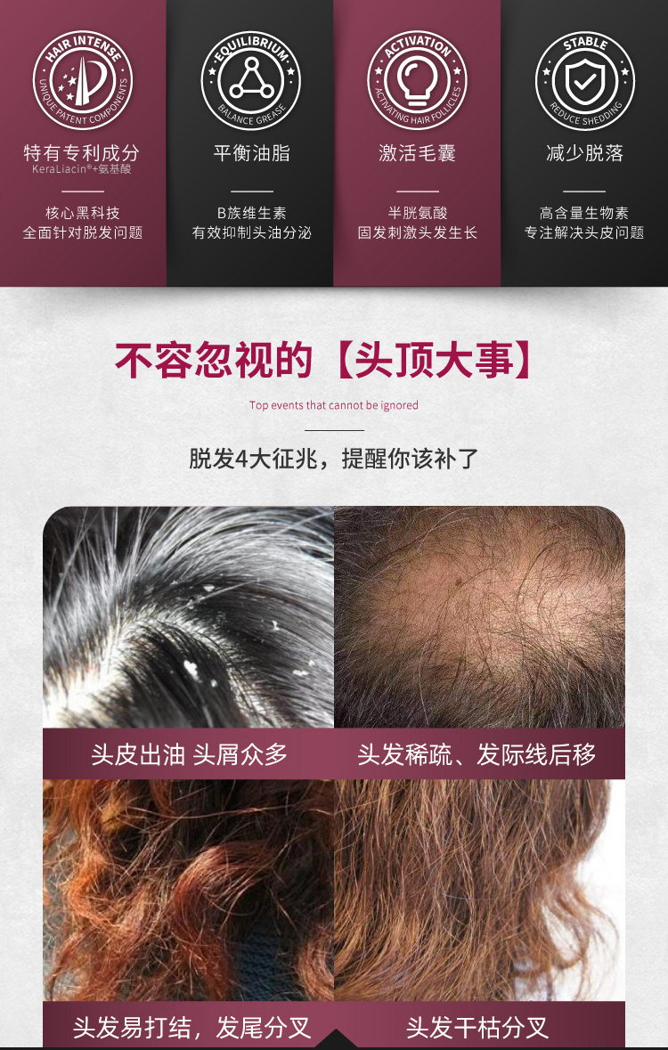 Orthomol 奥适宝防脱发生发胶囊