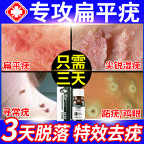 (Self-operated) Flat wart ointment spot mole ointment Yiwuling wart removal cream remove the roots and remove warts cream
