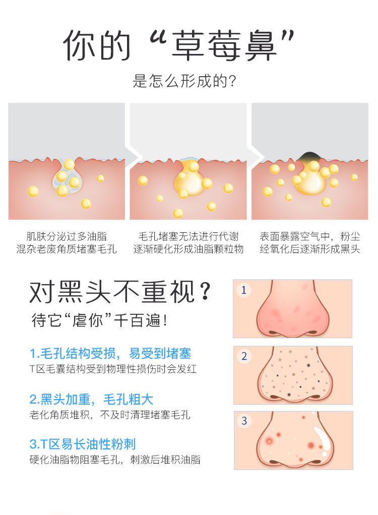 吸黑头神器电动吸出洗脸仪美容去毛孔机粉刺