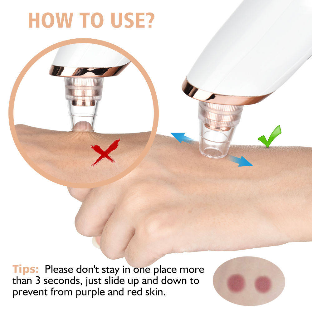 Сосать черный глава инструмент electric blackhead remover vacuum acne cleaner black spots r