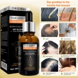 Hairgrowth Kit Carp Care Care Hair Wair Care Wair Mare набор эфирного масла