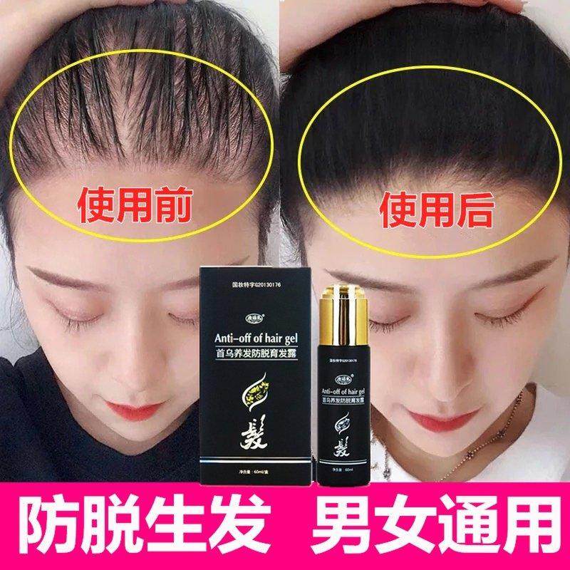 Hair growth anti-alopecia hair fluid black hair