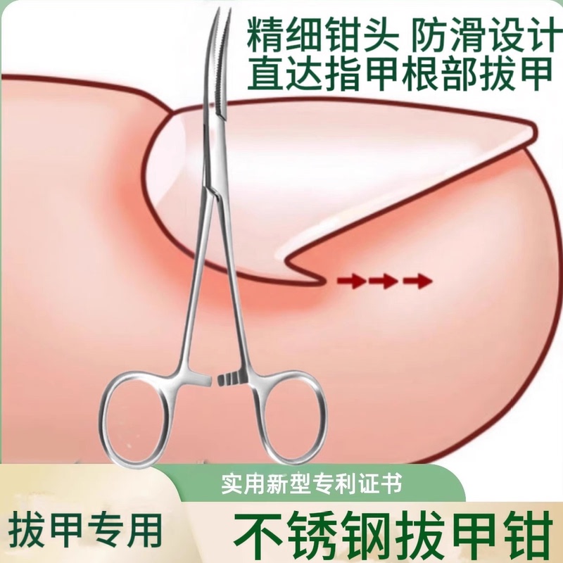 Special Pointed Nail Pliers for Ingrown Toenails, Ultra-Fine Nail Plucking Tweezers, Pedicure Tools (Same Model as Used in Pedicure Shops)
